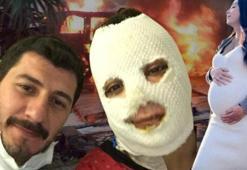 Yaptığı şakayı 15 gün sonra yaşadı! Irak'ta bombaların hedefi oldu: 'Öldüm sandım'