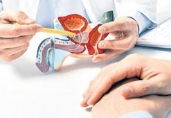 Prostat kanseri üzerine 8 soru 8 yanıt