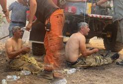 Türkiye onu bu görüntüyle tanıdı! Yangında ağır yaralanan orman işçisinin son hali...