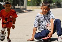 Kaykayla hayata tutunmuştu: Ayağındaki kemik yanlış kaynayan Serdal artık yürüyebiliyor