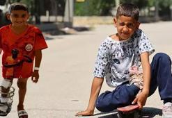 Ayağındaki kemik yanlış kaynayan Serdal artık yürüyebiliyor