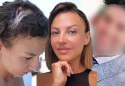 Uzaklaştırma kararı sonrası vahşet! Kafatasına zımba atıldı, elleri kırıldı: Plan yapıp beni öldürmeye geldi