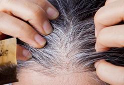 Beyazlardan boyasız kurtaran formül: Siyah çay ve elma sirkesi! Kuaföre para saçmayın