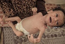 Gazze'de anneler sütten kesildi, bebekler ölümün eşiğinde: Ne mama var ne temiz su!