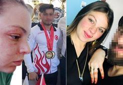 Dilan'ın kabus evliliği! Milli sporcu eşini şikayet etti: Gereksiz sebeplerle dayak yiyordum