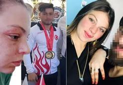Kendisini darbeden milli sporcu eşinden şikayetçi oldu
