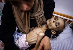 Gazze'de Meryem'in dramı: Fotoğraflar arasında sadece iki gün var!