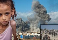 1 günde 8 kişi açlıktan, onlarcası yardım ararken öldü! Açlıktan ölmek nasıl bir his?