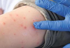 Bu yeni bir salgın mı? Önleme uyarısı