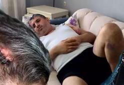 Miras anlaşmazlığı yaşadığı yeğenini, beyzbol sopasıyla dövdü