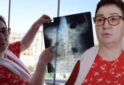 Hastanede ortaya çıktı: 22 yıldır karnında: 'Canlı bomba gibi geziyorum'