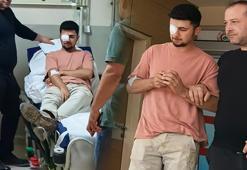 Ahşaptan fırlayan çivi gözüne saplandı: Görme yetisini kaybetti