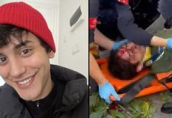 Oyuncu İbrahim Yıldız'ın üzerine ağaç devrildi! Hastaneye kaldırılan oyuncu ölüm kalım savaşı veriyor