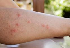 Evdeki sivrisinekleri avlayan karışım! Kokusunu alıp tuzağa düşüyorlar