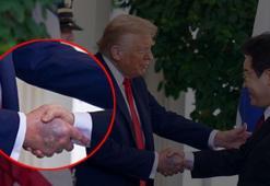 Trump'ın elindeki morluk hakkında Beyaz Saray'dan açıklama