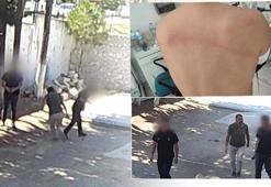 Belediye başkanından taş döşemek istemeyen zabıta memurlarına dayak: Sırtımda sopanın izleri halen duruyor