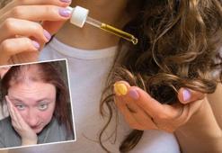 Saçındaki kelleşmeyi bu malzemeyle bitirdi! Duştan sonra uygulayın, kafein mucizesi