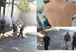 Belediye Başkanından taş döşemek istemeyen zabıta memurlarına dayak: Sırtımda sopanın izleri halen duruyor