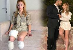 Fitness eğitmeni en mutlu gününde 2 bacağını kaybetti! ‘Evlilik yıl dönümüm cehenneme döndü’