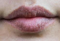 Saniyeler içinde pürüzsüz dudak görünümü! Yağların nasıl kullanılacağını öğrenin