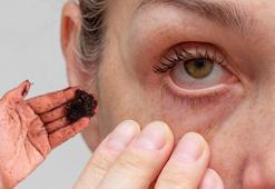 Uykuda şişen gözleri söndüren maske! Elinizle ovmayın, sürünce alerji kalmıyor