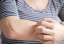 Hatır hutur kaşınıyorsanız çaresi var! Meğer kış için en etkili formül azıcık jel ve balmış