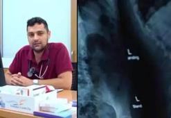 1,5 yıldır süren öksürük kâbusunun nedeni herkesi şaşırttı