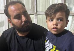 Şanlıurfa'da korkunç olay! 4 yaşındaki çocuğa yorgun mermi isabet etti