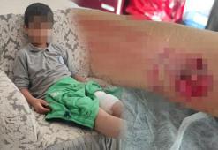 Okula giderken sokak köpeğinin saldırısına uğradı