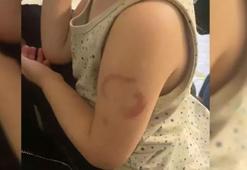 Kreşte kan donduran olay! Çocuk bakıcısı tutuklandı