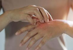 2 ürünle elleri pamuk gibi yapıyor! Gerginlik ve kaşıntıya da birebir