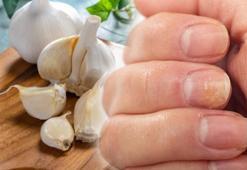 Tırnak mantarından dakikalar içinde kurtulun! 10 farklı yöntemi var: 3 damlası yetiyor