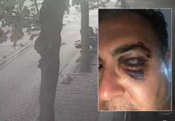 Kedi beslemek isteyen iş insanına 'Yolu kapattın' dayağı