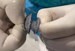 Kalpteki delik artık korkutmuyor: Modern kapalı yöntemle 15 dakikada tedavi