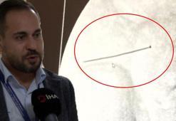 Ağrıyla kıvranan 2 yaşındaki çocuk doktorları şoke etti! 'Ölümüyle sonuçlanabilirdi'