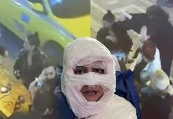 Kadıköy’de vahşet! Çakmakla yakılan kadına kan donduran mesajlar: 'Kız arkadaşım sizin yüzünüzden hapse girdi...'