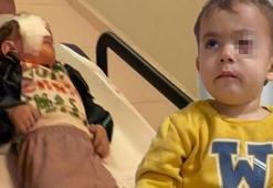 Bursa'da torpil felaketi! 2 yaşındaki çocuğu kör etti: '1 hafta önce satmasın diye yalvarmıştım'