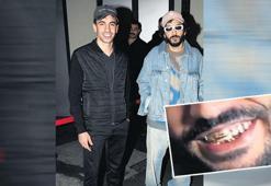 Altın dişleri göz aldı