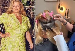 56 yaşında hayatının şokunu yaşadı! Kafasındaki kaşıntı bit değilmiş