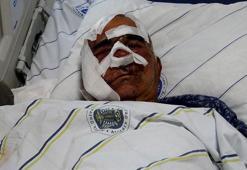 Kentte 5'inci ayı dehşeti! Hayvan otlatırken saldırdı: 'Yüzünde çok büyük kesiler, yırtıklar vardı'