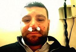 Trafikte yol verme dehşeti! Avukatın burnu kırıldı: 'Elindeki cisimle vurdu, kafa attı'