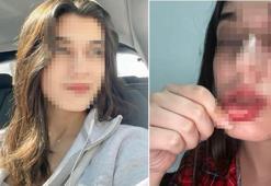 Sosyal medyadan paylaştı, dehşeti anlattı: Tek başıma tuzağa düşürüp bana saldırdı