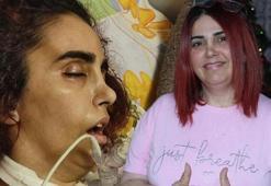 1 yılda hayatı karardı! 45 gün komada kaldı, beyin felci geçirdi: Doktorlar iyileşmemin mümkün olmayacağını düşünüyordu