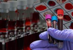 Dünyada sadece 50 kişide var! 'Altın kan' laboratuvarda üretilebilecek mi?