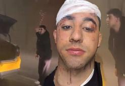 İstanbul'da taksici dehşeti! 'Sopayla kafama 10 defa vurdu'