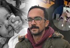 12 kez şikayet edilmiş: İlla çocuğumun suratının parçalanması mı gerekiyordu?