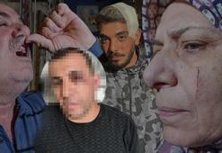 Adana’da komşu dehşeti! Babanın dişlerini kırdı, anne ile oğlunu bıçakladı: 'Beni kışkırtıyordu'