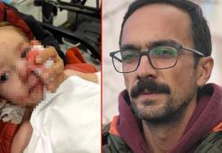 Pitbull dehşetinde yüzünden yaralanan minik Efe'den haber geldi: 'Ne yazık ki izler kalacakmış'