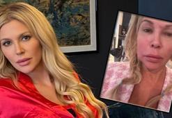 Yüzü eriyordu! Gizemli hastalığın sırrı ortaya çıktı