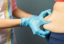 Kilo veremiyorsanız suçlu iradeniz değil! Genetik kodunuzda lipödem olabilir